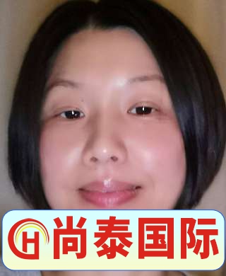 張阿姨
